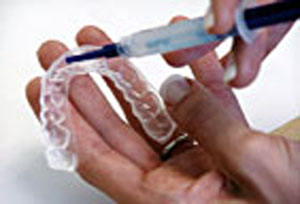 Soft transparent trays are filled with whitening gel.