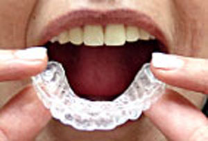 The trays fit tightly over your teeth and are worn for the prescribed time