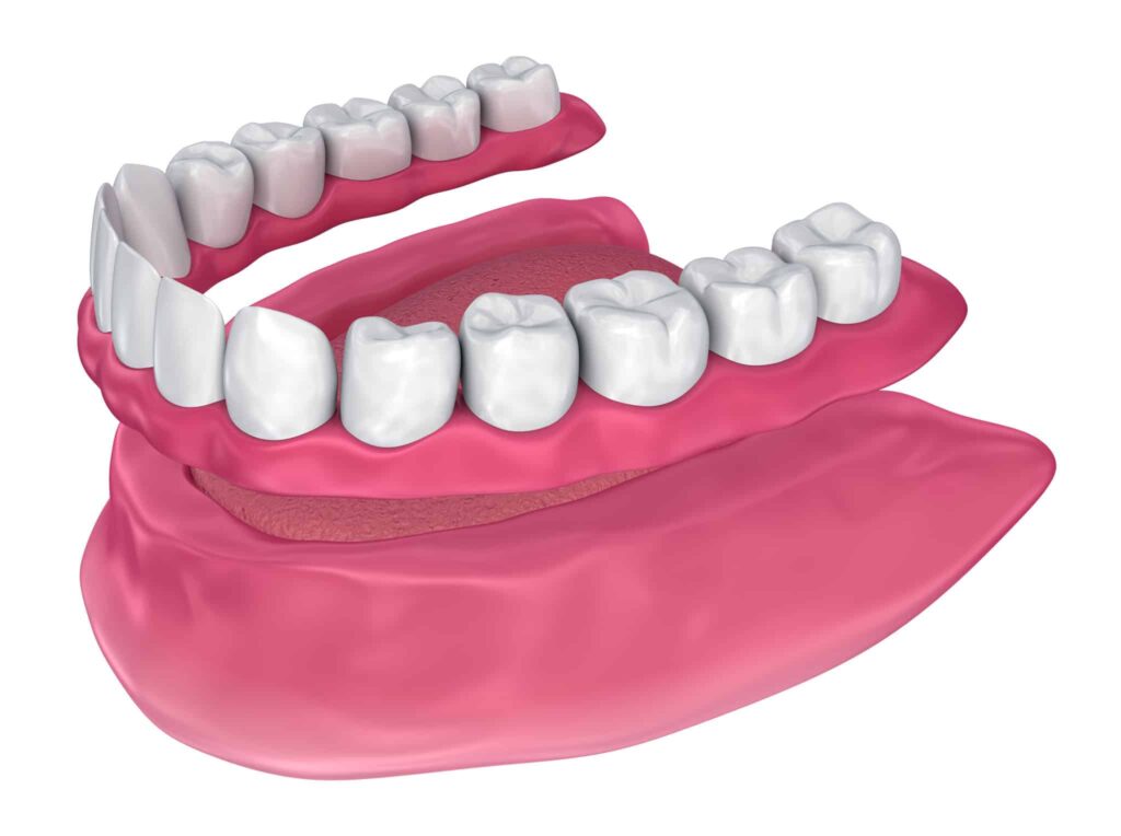 Dentures diagram
