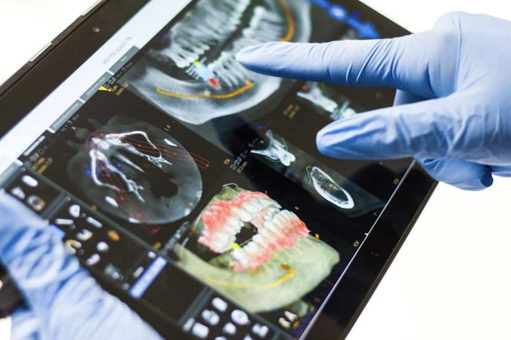 Dentist reviewing digital dental X-ray scans on a tablet