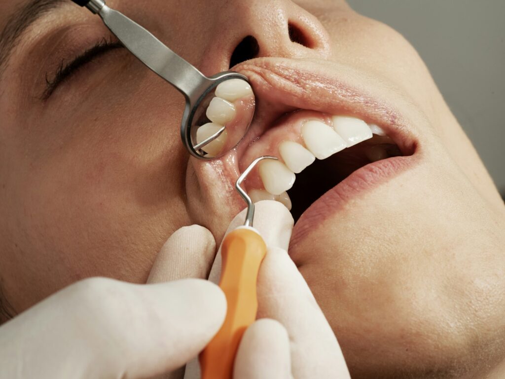 Dentist examining a patient's gums during a periodontal exam