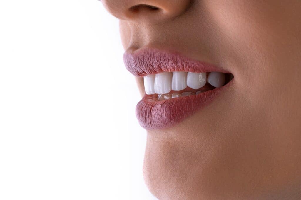 Close-up of bright white teeth after a professional whitening treatment at Twin Mountain Dentistry